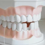 Replacing Missing Teeth